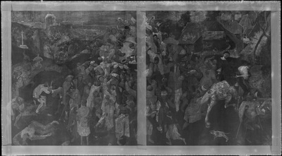 FOTOGALERIA: Radiografía
