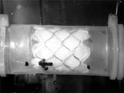 Cambio de válvula pulmonar sin cirugía a corazón abierto