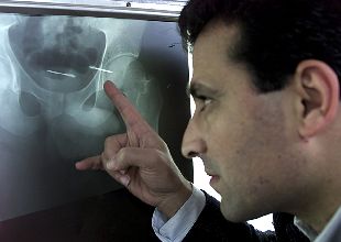 Un doctor señala dos proyectiles alojados en la pelvis de un palestino muerto por soldados israleíes. Los palestinos acusan a Israel de usar a menudo este tipo de proyectiles que quedan enganchados a los órganos internos.