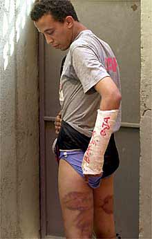 Addelhak A. muestra las lesiones producidas por la paliza.