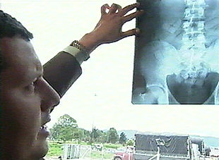 Un responsable de aduanas muestra una radiografía en la que se observan bolas de droga alojadas en el estómago.