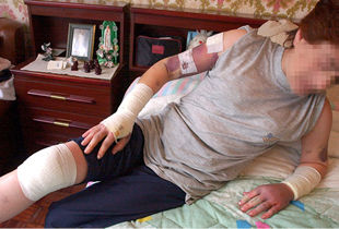 María Luz muestra las heridas y hematomas que le causó su marido.