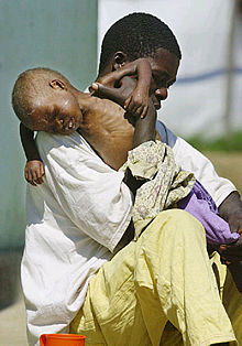 Un enfermero con un niño víctima del hambre, en un hospital de Kuito (Angola).