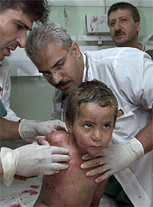 Los médicos atienden a un niño palestino herido en el hospital de Gaza.