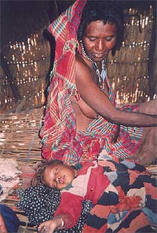 Un niño enfermo de malaria, en la aldea de Doho.