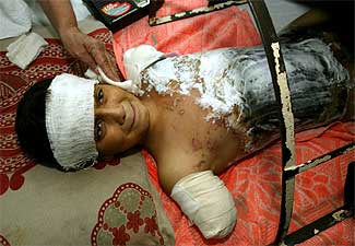 El niño Alí sigue grave en un hospital de Bagdad