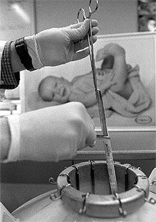 Extracción de un embrión de un recipiente congelado.