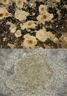 FOLÍCULOS GENERADOS EN CULTIVO.