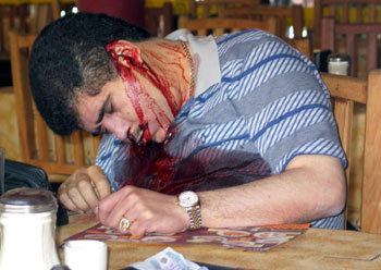 Edelio López, alias  El Yeyo,  asesinado ayer mientras desayunaba en un restaurante en Guadalajara (México).