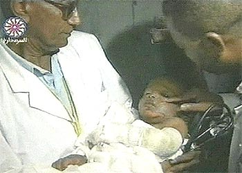 Imagen de la televisión sudanesa en la que aparece el niño superviviente en manos de los médicos.