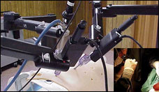 Trasplantes: cuando la esperanza falla