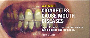 Imagen de una campaña canadiense contra el tabaco.