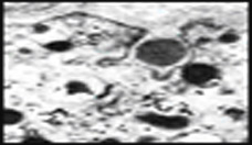 La revolución de las células madre