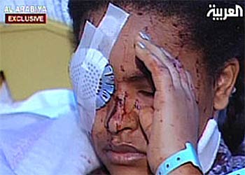 Imagen de una de las víctimas, recogida por la cadena de televisión Arabiya.