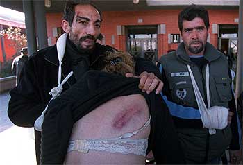 LAS HERIDAS DE LA 'BATALLA' DE LA PAZ.