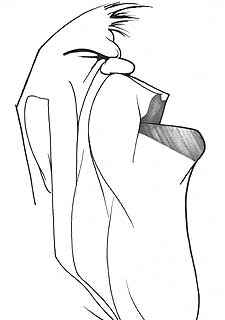 La rodilla mágica de Milosevic