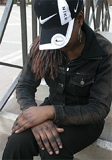 Ida (nombre ficticio) muestra sus manos, decoloradas por el  khessal,  esta semana en Madrid.