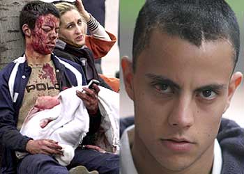 EN EL 11-M Y DESPUÉS. Sergio Gil fue uno de los primeros heridos que fueron fotografiados tras estallar las bombas. A la derecha, ayer en su casa.rnrn  EFE  SANTI BURGOS