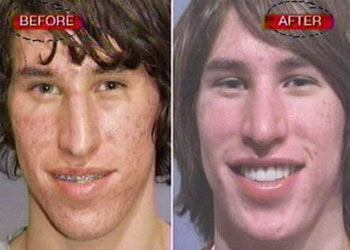 Uno de los jóvenes que aspiran a parecerse a Brad Pitt, antes y después de su paso por  Quiero una cara famosa .