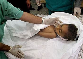 VÍCTIMA DE TRES AÑOS.