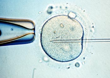 Manipulación en laboratorio de un óvulo humano.