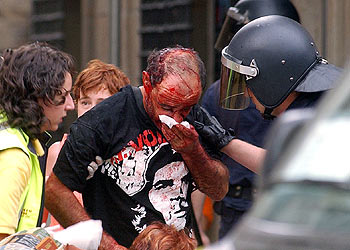 Un viandante que recibió una pedrada en los incidentes posteriores a la concentración en apoyo a los  okupas. 