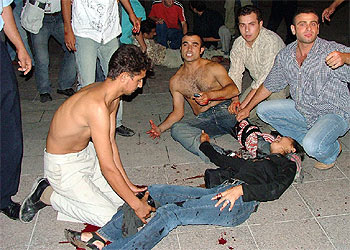 18 heridos al estallar una bomba durante un concierto en Turquía