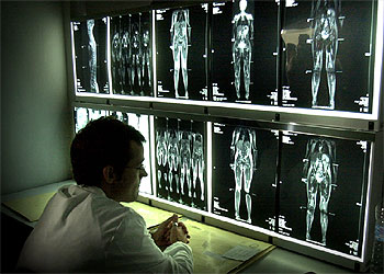 Nueva resonancia magnética en el hospital La Fe