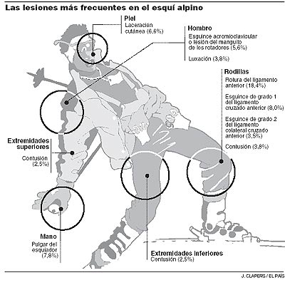 La mayor parte de las lesiones de esquí puede evitarse con una mejor preparación física