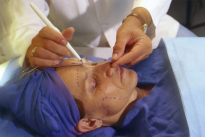 Preparativos para intervenir en la cara de una paciente.