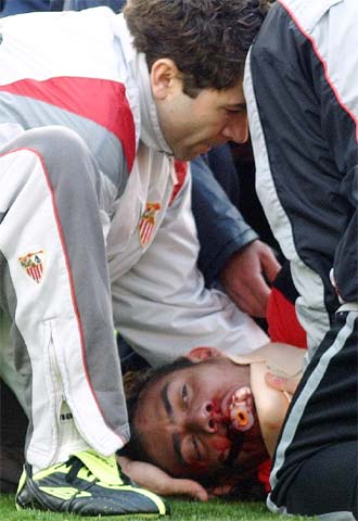 Arango es atendido en el césped tras la entrada de  Navarro. Abajo, secuencia de la acción.