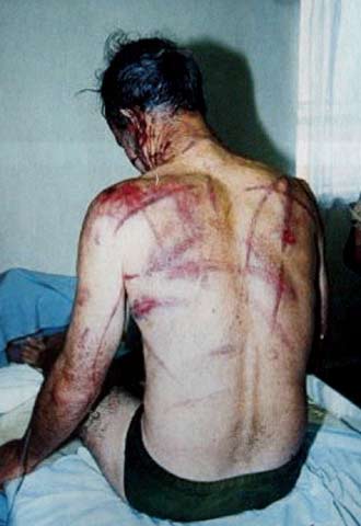 EL RASTRO DE LAS TORTURAS