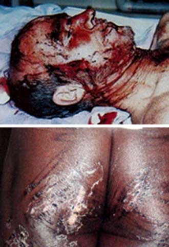 EL RASTRO DE LAS TORTURAS