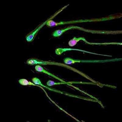 Muestra de esperma humano.