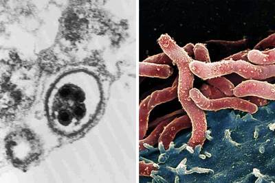 Imágenes del virus del herpes asociado con el sarcoma de Kaposi (izquierda) y de la bacteria  Helicobacter pylori,  que causa linfomas y úlceras de estómago.