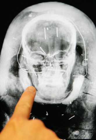 Científicos belgas escanean una momia para reconstruir sus rasgos