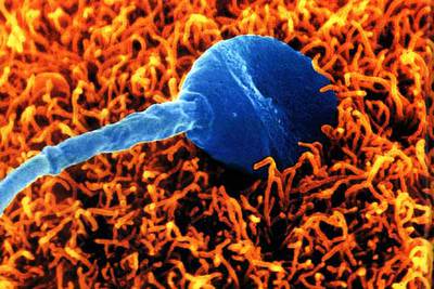 Un espermatozoide humano intenta fecundar un óvulo. Imagen de microfotografía electrónica.