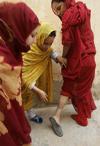 Una mujer saharaui muestra un golpe del que culpa a la policía.