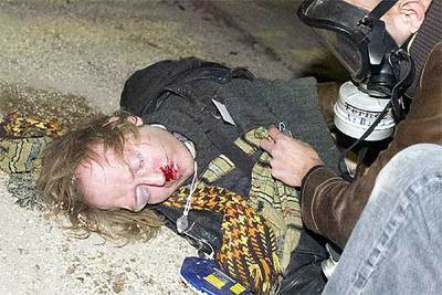 El sindicalista herido en un choque con la policía, el sábado en París.