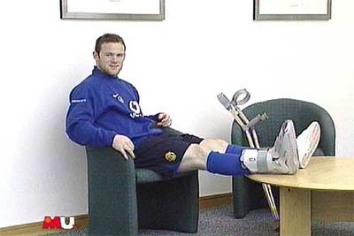 Rooney, con el pie escayolado.