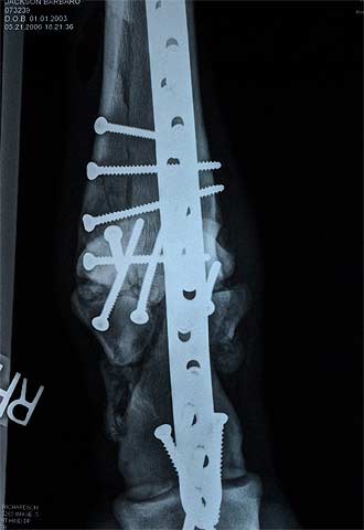 Imagen de la radiografía de la pata tras su operación.