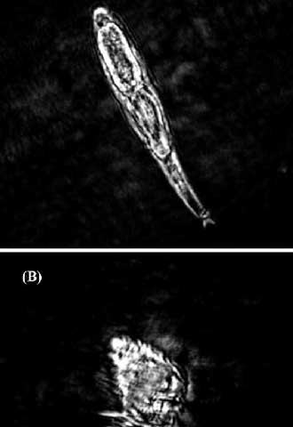 Imágenes de microorganismos captadas en el mar.