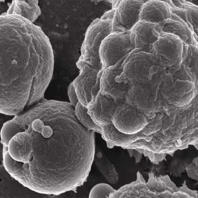 Linfocito (abajo a la izquierda), en el acto de fagocitar agentes exógenos.