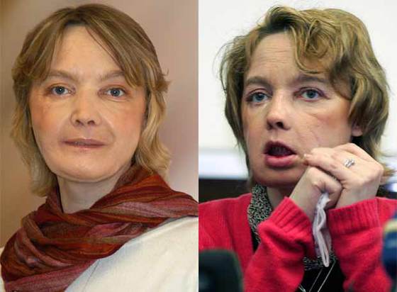 Los médicos confirman el éxito del primer trasplante de cara