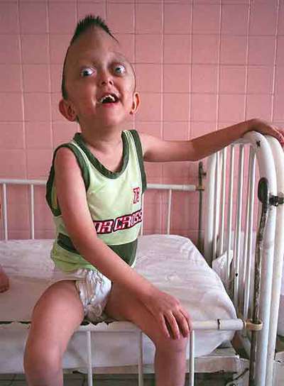 Niños asistidos en el Poblado de la Paz para víctimas del  agente naranja 