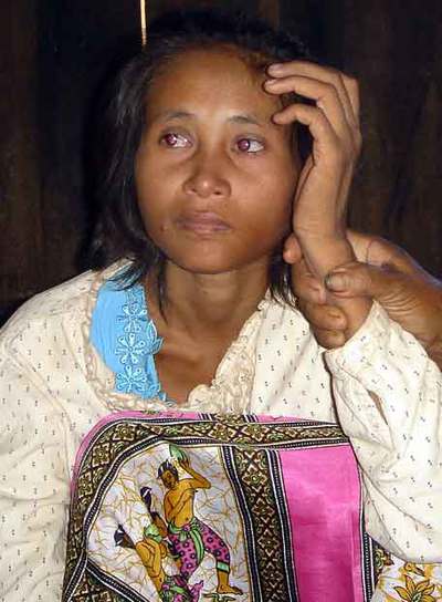 Rochom P'ngieng, fotografiada en la aldea de Camboya donde la hallaron.