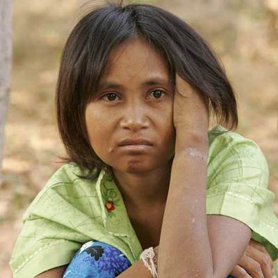 Rochom P'ngieng, la  mujer salvaje  descubierta recientemente en Camboya.