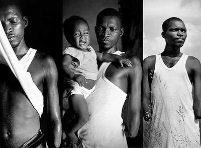 Serie fotográfica  Vivir mutilado, Sierra Leona,  de Yannis Kontos, galardonada con el primer premio.