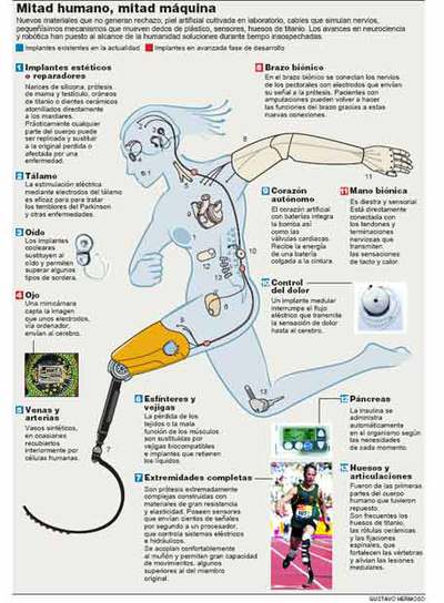 La revolución del hombre biónico