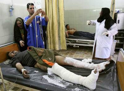 Un herido en un atentado con una bomba de cloro yace el pasado martes en un hospital de Bagdad.